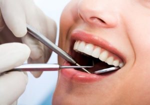 Cosmetic dentistry at Smiles of Bellevue and Eastside Smiles