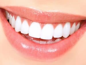 teeth-whitening-smiles-of-bellevue